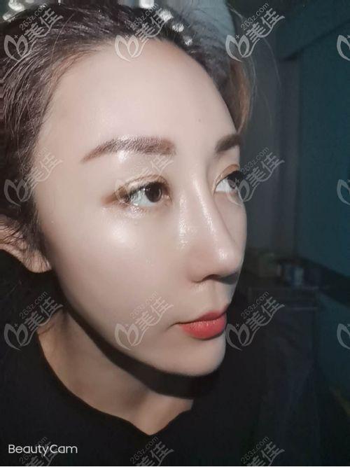 国产膨体材料视频